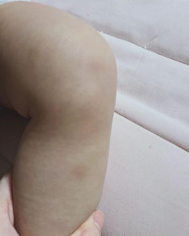 Nóng: Ahreum (T-ara) nhập viện cấp cứu khi bị truy tố-6