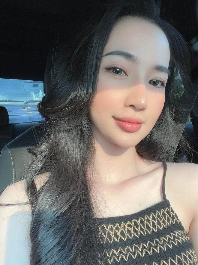 Tình hình hiện tại của em vợ Lê Dương Bảo Lâm sau vụ tai nạn nát nửa xe-6