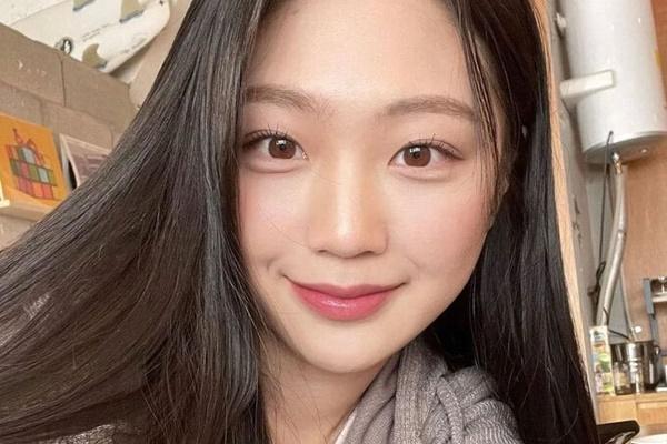 4 cách chăm sóc da sau điều trị nám-4