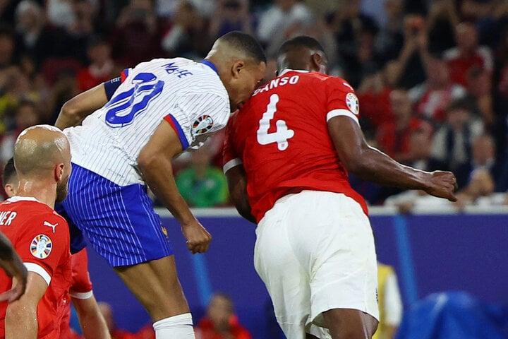 Cận cảnh pha va chạm khiến Mbappe đổ máu, đến thẳng bệnh viện-2