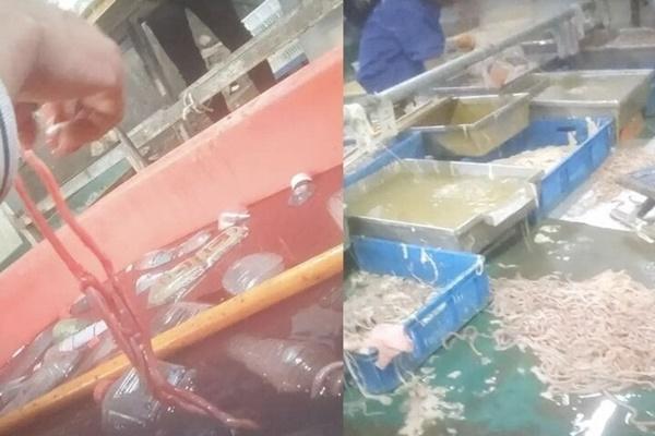 Sau khi ăn lẩu, thực khách hoảng hồn phát hiện lưỡi chuyển màu đen kịt-2