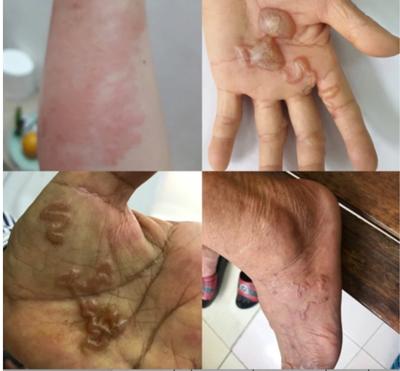 Cảnh báo nhiễm bệnh từ thú cưng-2