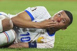 Mbappe vỡ mũi ngay trận ra quân, EURO khắc nghiệt hơn World Cup