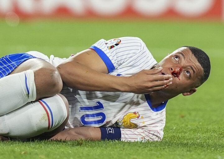 Mbappe vỡ mũi ngay trận ra quân, EURO khắc nghiệt hơn World Cup-3