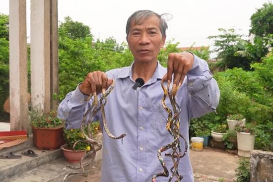 Dị nhân Nam Định móng tay dài 1m vì 33 năm không cắt, giờ muốn bán với giá 7 tỷ đồng