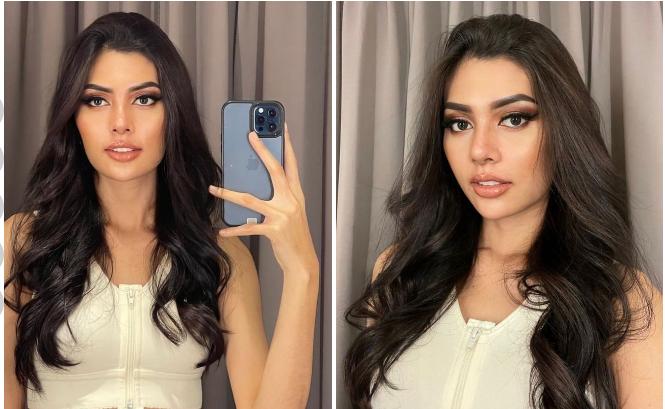 Ngoại hình Hoa hậu Hòa bình Indonesia 2024 sau thẩm mỹ-1