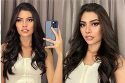 Ngoại hình Hoa hậu Hòa bình Indonesia 2024 sau thẩm mỹ