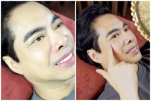 Cười ra nước mắt khi loạt sao nam đổ xô đi tân trang nhan sắc tuổi xế chiều-3