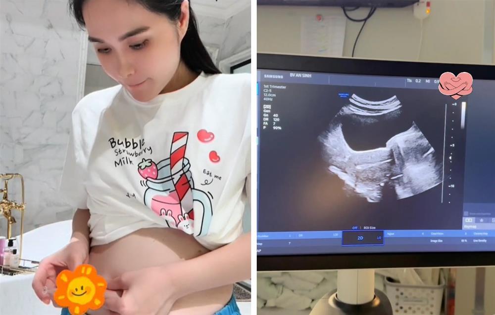 Ly kỳ chuyện đi làm IVF của nữ đại gia quận 7, khẳng định cho chồng đi triệt sản ngay và luôn vì lo lắng điều này-2