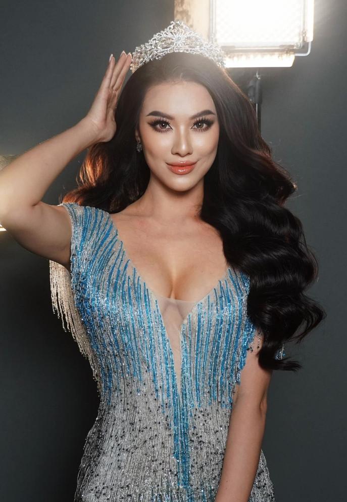 Vì sao á hậu Kim Duyên hay bị mổ xẻ, soi xét?-5