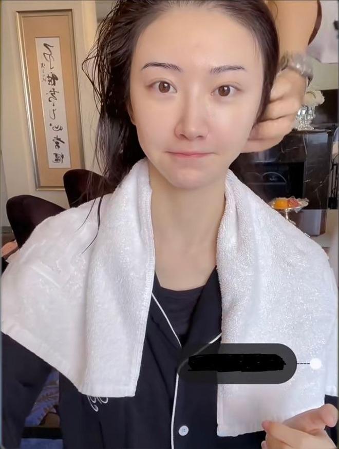 Đệ nhất mỹ nữ Cảnh Điềm tự hủy hoại nhan sắc vì bơm mặt cắt mí?-5