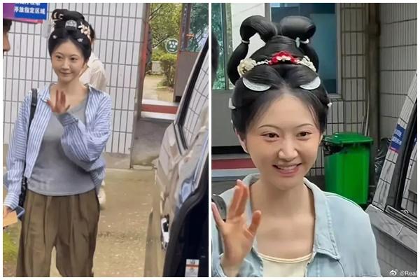 Đi cắt mí, cô gái bị khâu nhãn cầu với khóe mắt, muốn nhìn phải quay đầu-3