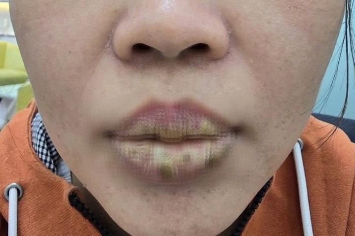 Gặp ‘quả đắng’ sau khi thuê thợ về nhà xăm lông mày, môi để đổi vận-1