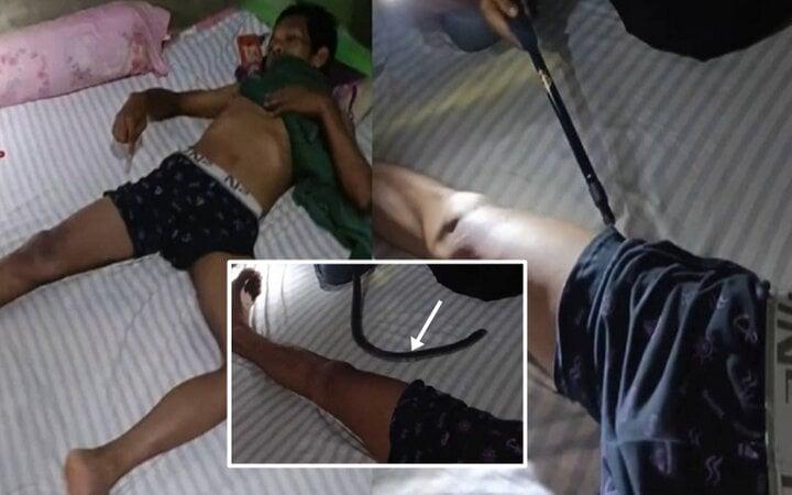 Giải cứu người đàn ông bị rắn hổ mang chui vào quần lúc đang ngủ-1