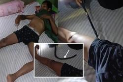 Giải cứu người đàn ông bị rắn hổ mang chui vào quần lúc đang ngủ