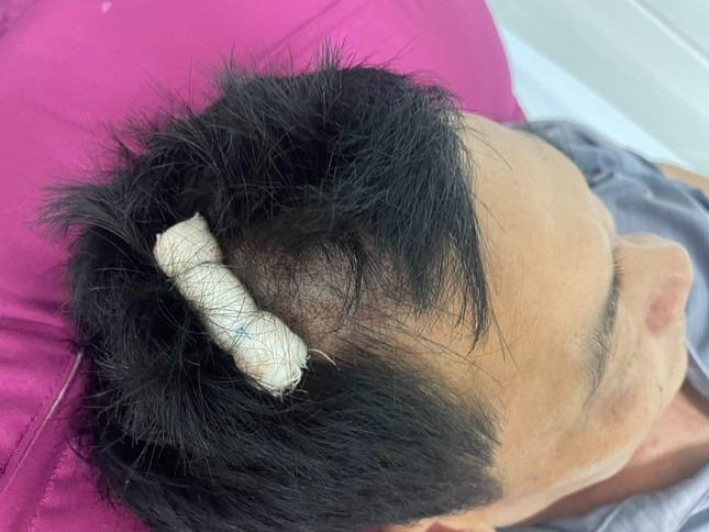 Cán bộ xã dùng cốc đập vào đầu người dân trong quán nhậu-3