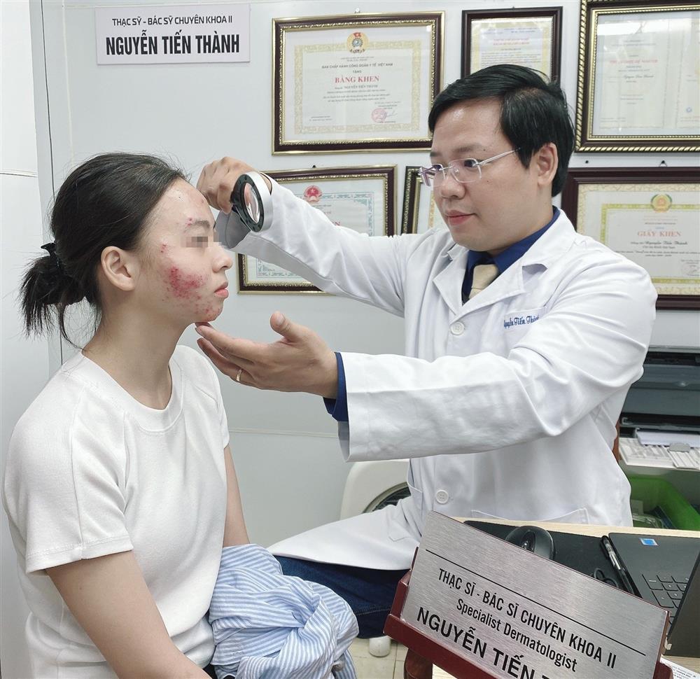 Mặt tan nát sau 3 tuần uống thuốc tránh thai điều trị mụn-1