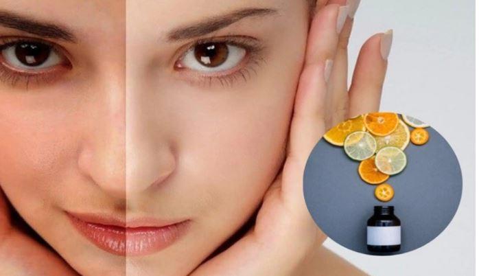 6 dấu hiệu phụ nữ thiếu Vitamin C trầm trọng
