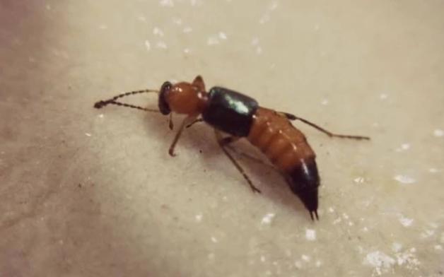 Mùa mưa đến, kiến ba khoang hoành hành, hàng trăm người ở TP.HCM biến dạng da vào viện cầu cứu vì dịch độc-3