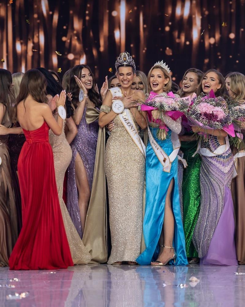 Top 3 Hoa hậu Ba Lan bị chê già như trung niên-1