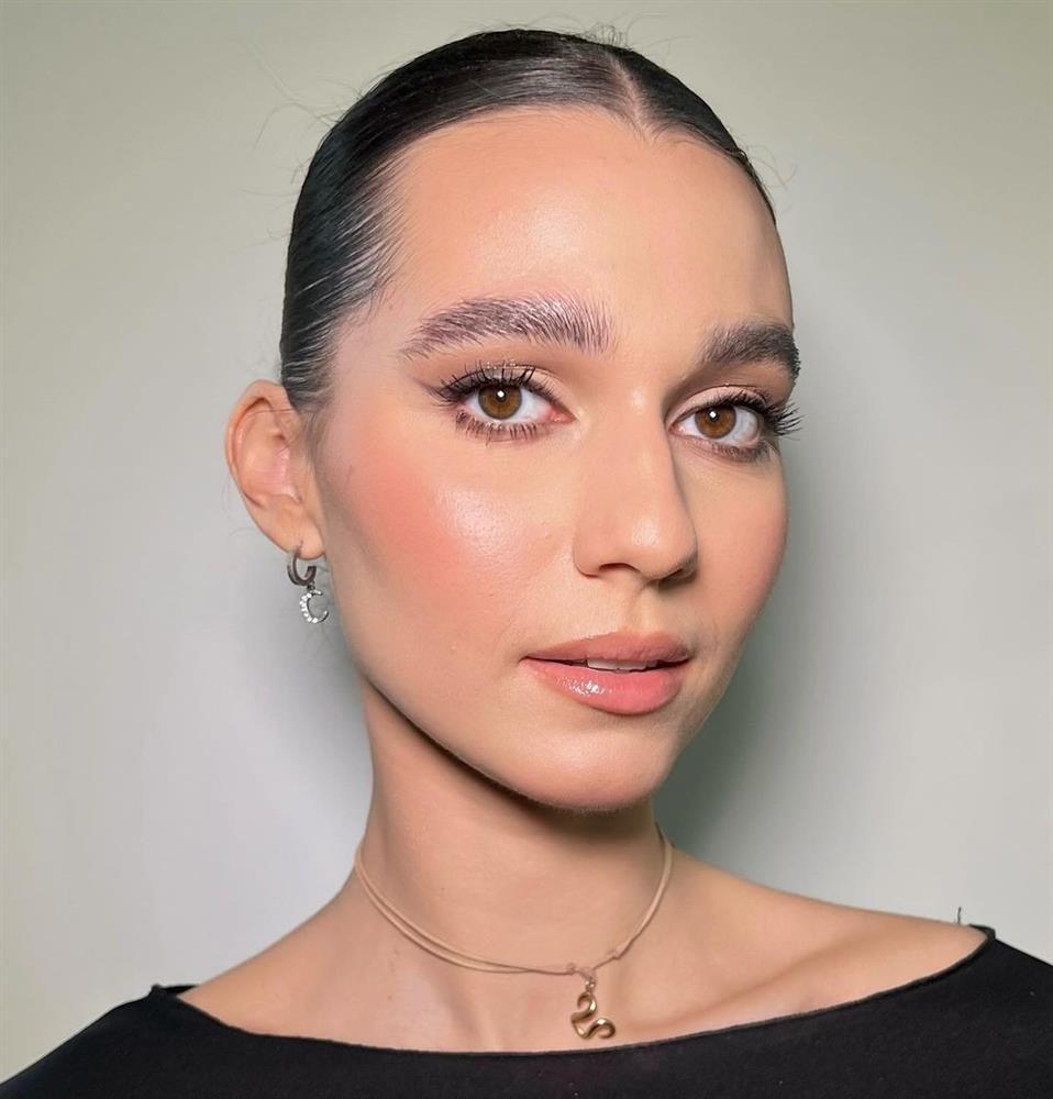 Top 3 Hoa hậu Ba Lan bị chê già như trung niên-5