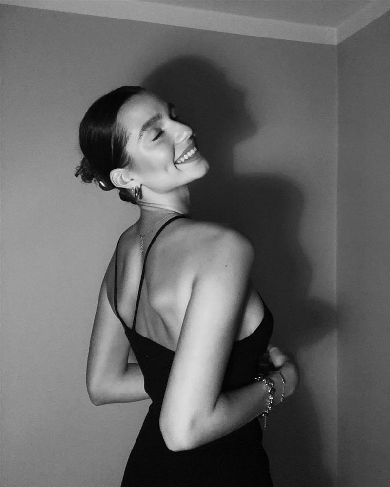 Top 3 Hoa hậu Ba Lan bị chê già như trung niên-7