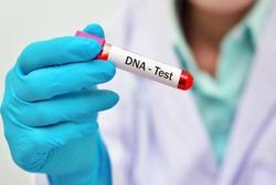 Bố sốc và sụt 15 kg khi phát hiện con gái không cùng huyết thống sau khi xét nghiệm ADN