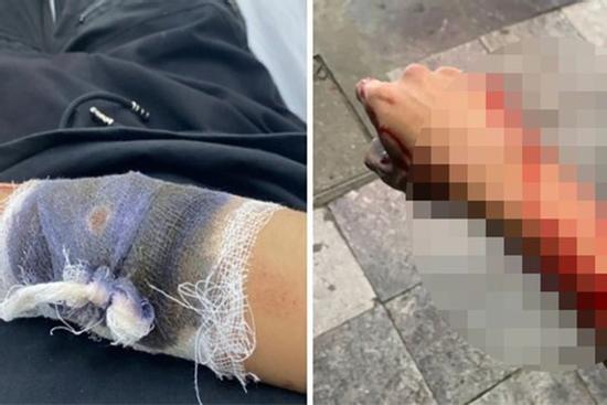 Công an Hà Nội truy lùng toán cướp gây án trước Nhà hát Lớn