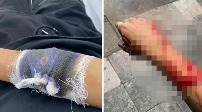 Công an Hà Nội truy lùng toán cướp gây án trước Nhà hát Lớn