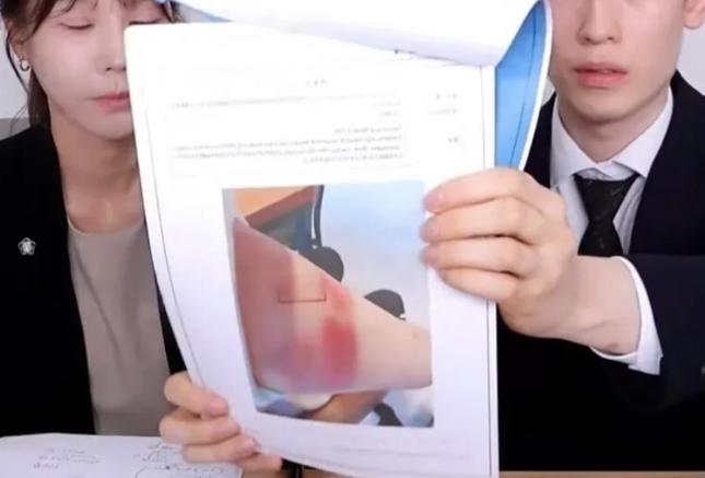 Toàn cảnh vụ thánh mukbang nổi đình đám tiết lộ bị bạn trai bạo hành suốt 4 năm-5