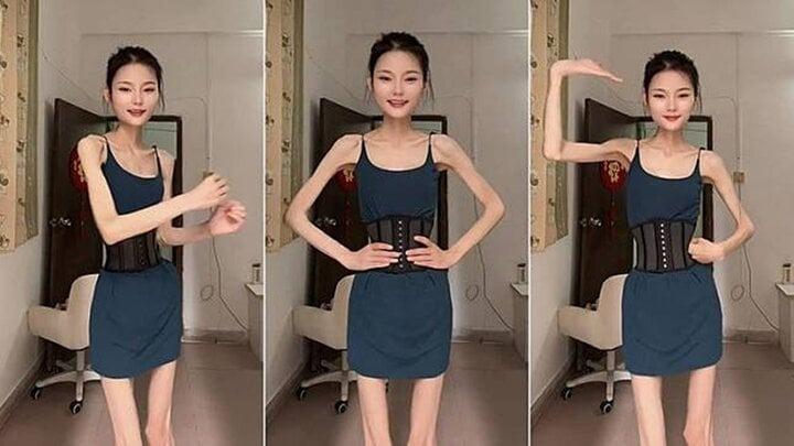 Bị gọi là Bạch Cốt Tinh do quá gầy, cô gái nặng 25kg vẫn muốn giảm cân