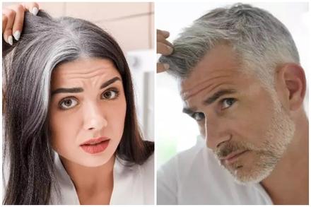 6 nguyên nhân khiến người trẻ tóc đã bạc trắng