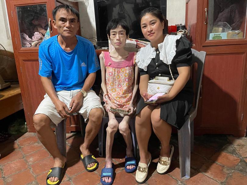 Cô gái Hưng Yên nặng 18kg sau nhiều năm không ăn cơm để giảm cân-2