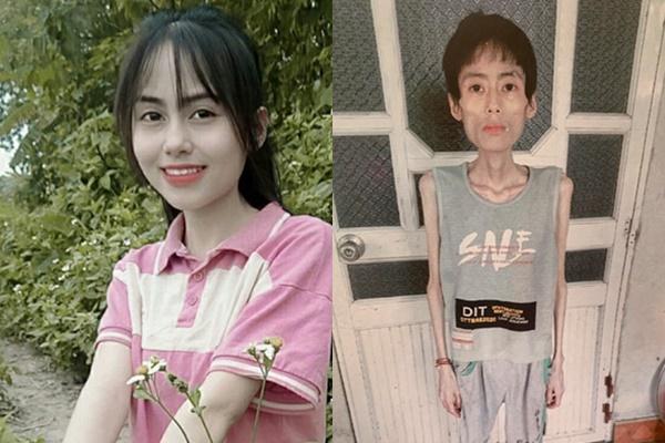 Cô gái Hưng Yên nặng 18kg hạnh phúc báo tin vui-5