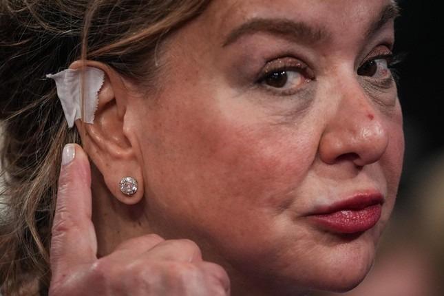 Băng tai của ông Trump thành xu hướng-3