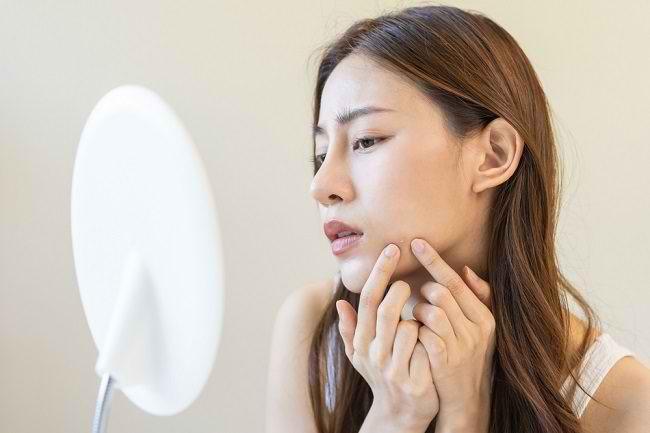 Mụn ẩn có nên nặn không
