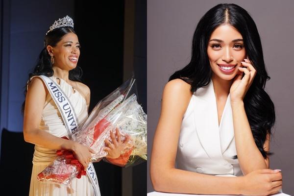 Hoa hậu Hoàn vũ Trung Quốc bị chê-2