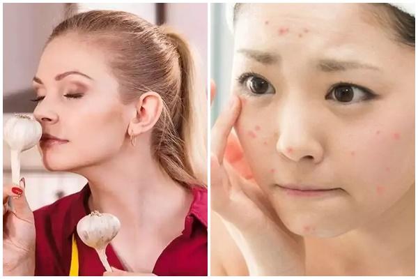 Miếng dán mụn thành phụ kiện thời trang khiến gen Z phát cuồng-4