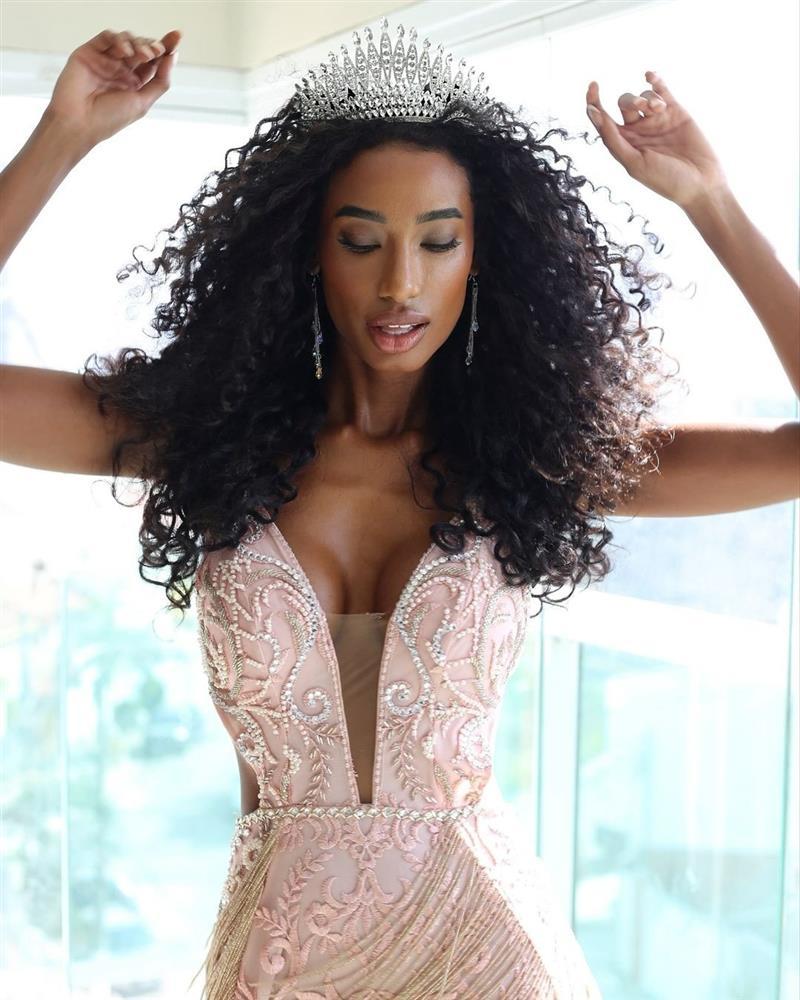 Cô gái bị miệt thị ngoại hình đăng quang hoa hậu ở tuổi 34-1