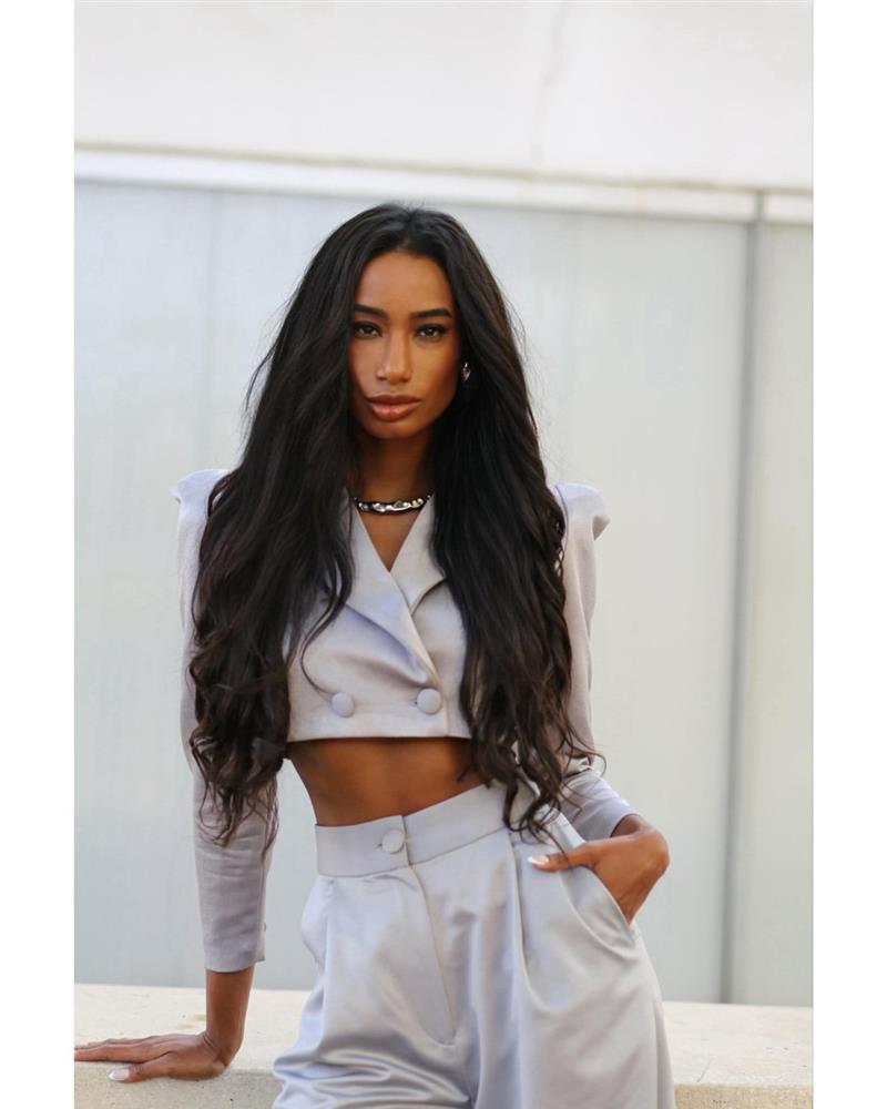 Cô gái bị miệt thị ngoại hình đăng quang hoa hậu ở tuổi 34-6