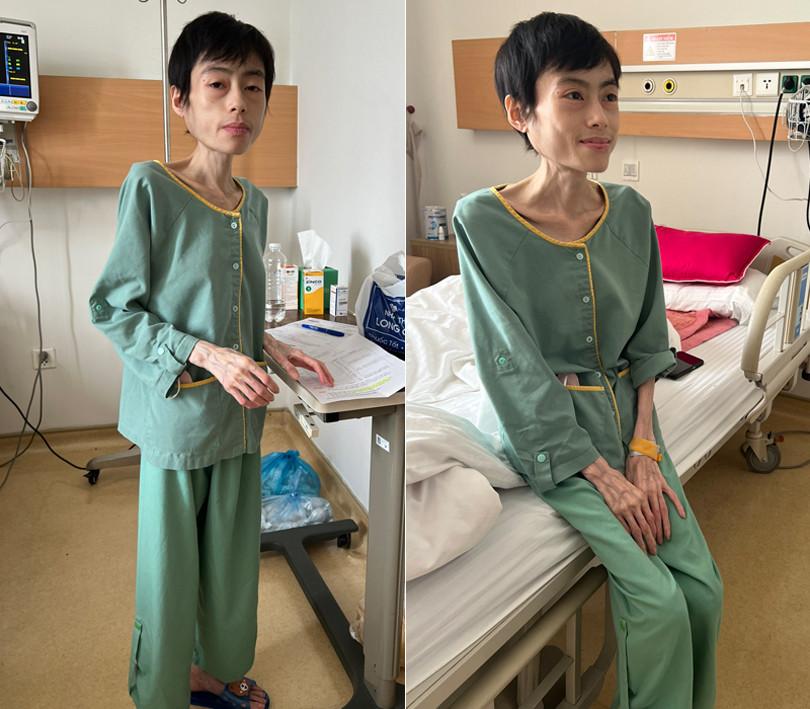 Cô gái Hưng Yên nặng 18kg hạnh phúc báo tin vui-2