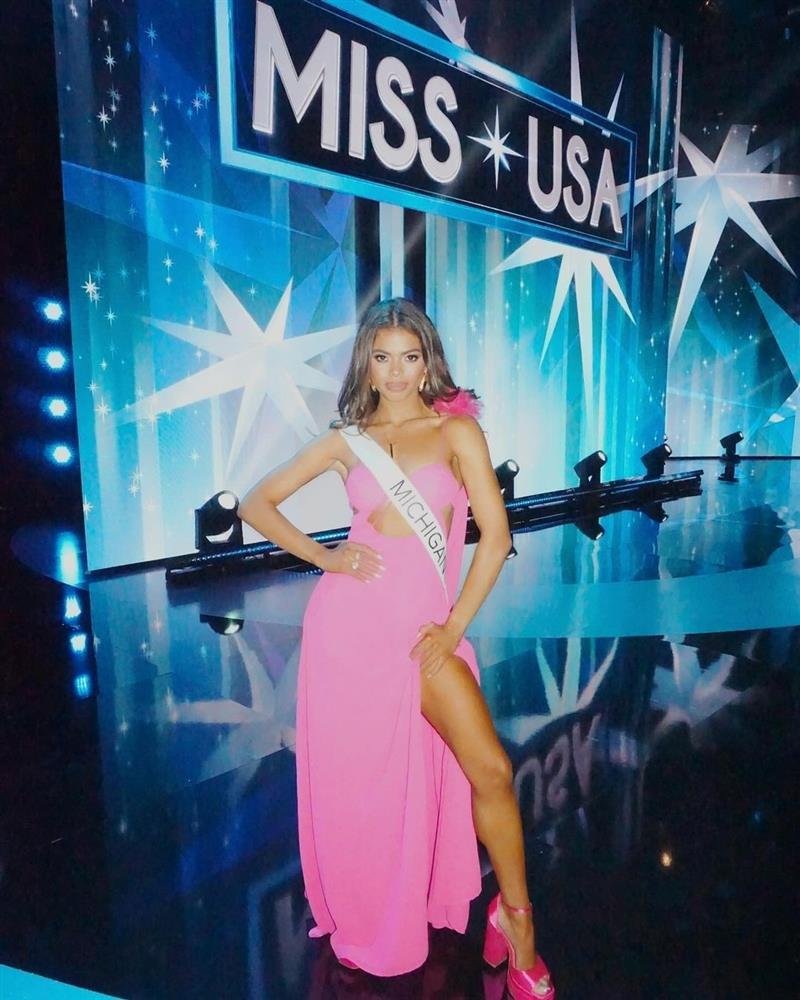 Nhan sắc Hoa hậu Mỹ 2024 gây tranh cãi-6