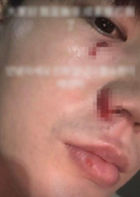 Hoa hậu bị tố đánh chồng-1