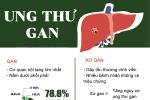 Tăng 50% nguy cơ mắc ung thư do thói quen tưởng vô hại trước khi đi ngủ-2