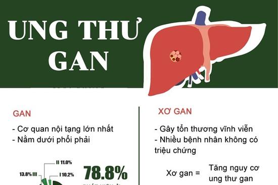 Nhìn vào mắt, phát hiện dấu hiệu ung thư gan