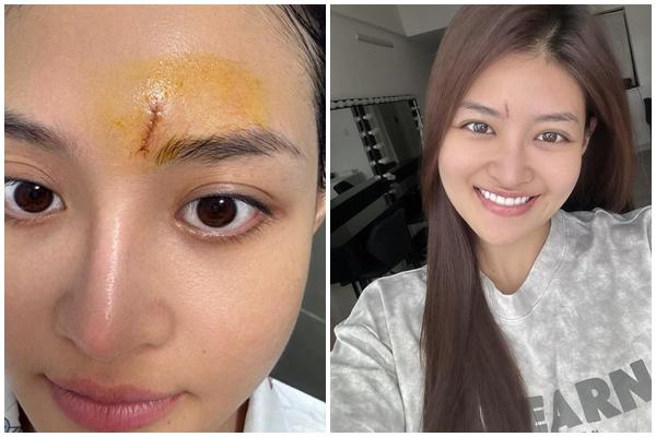 Diễn viên Thùy Anh: Tốt nghiệp 2 trường đại học, lúc bế tắc ra đảo một mình-4