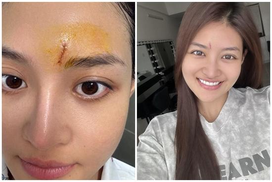 Diễn viên Thùy Anh: 'Tôi sốc khi bị đòi bồi thường hơn 20 tỷ đồng'