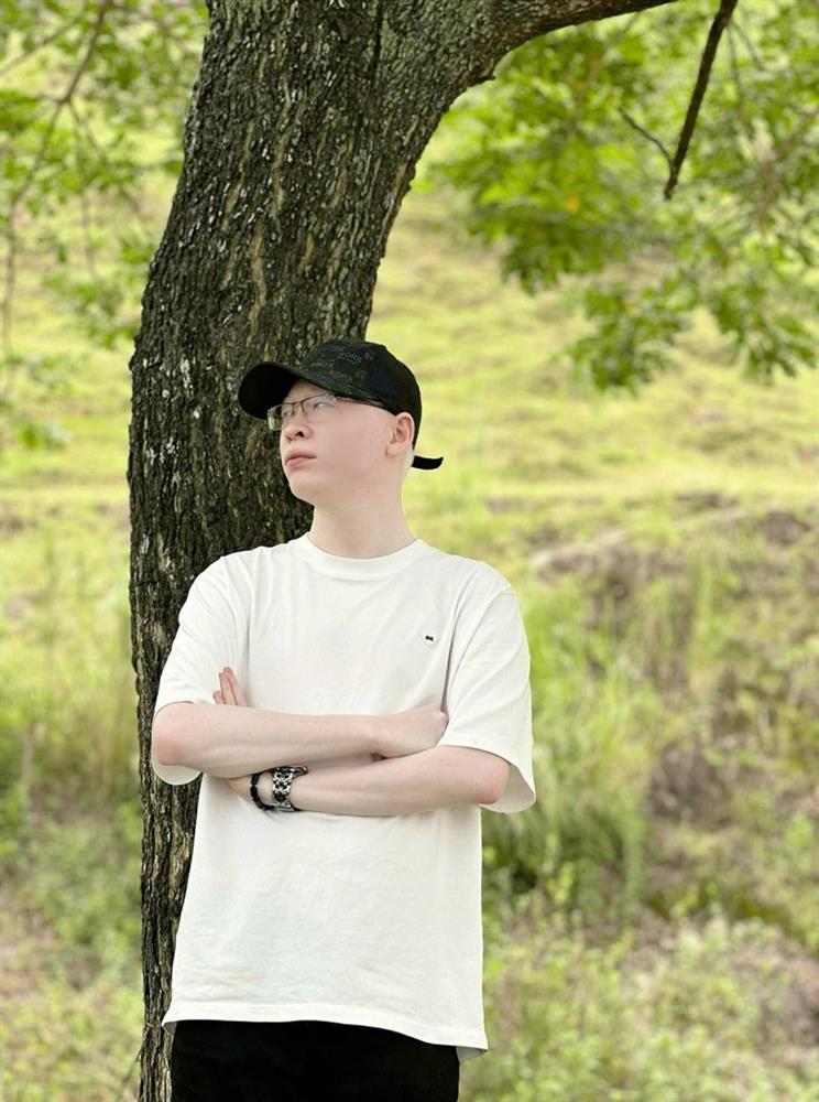 Bước ngoặt hồi sinh cuộc đời cặp song sinh bạch tạng ở Hà Tĩnh-4