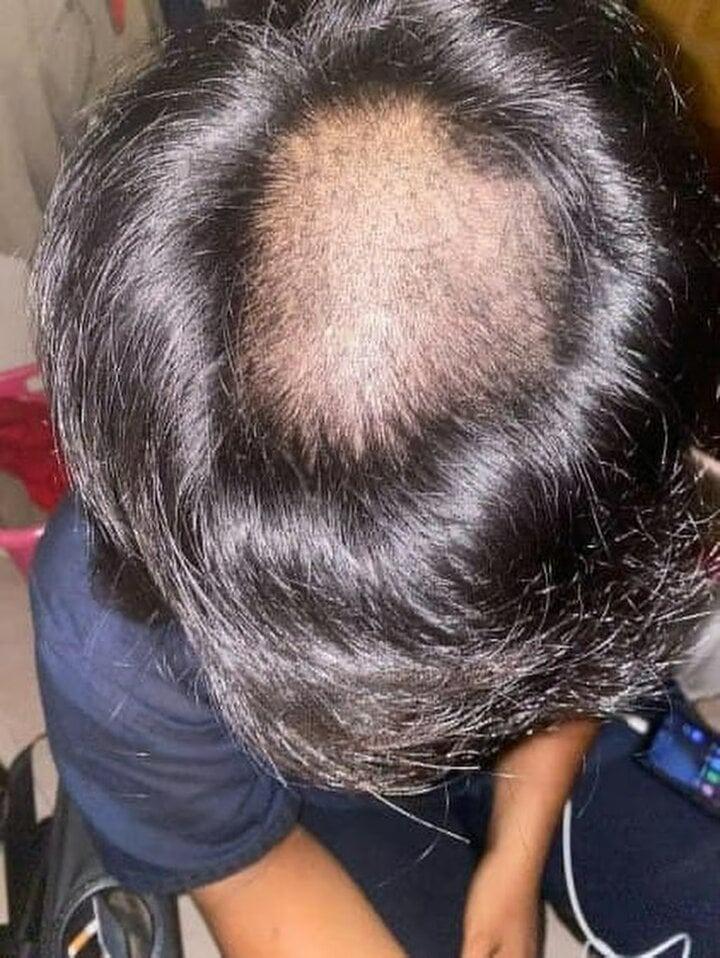 Giáo viên cao đẳng gây phẫn nộ khi phạt cạo đầu 66 học sinh-1