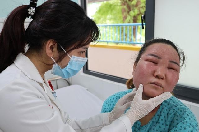 Người phụ nữ ở TPHCM nhập viện sau khi tự peel da tại nhà